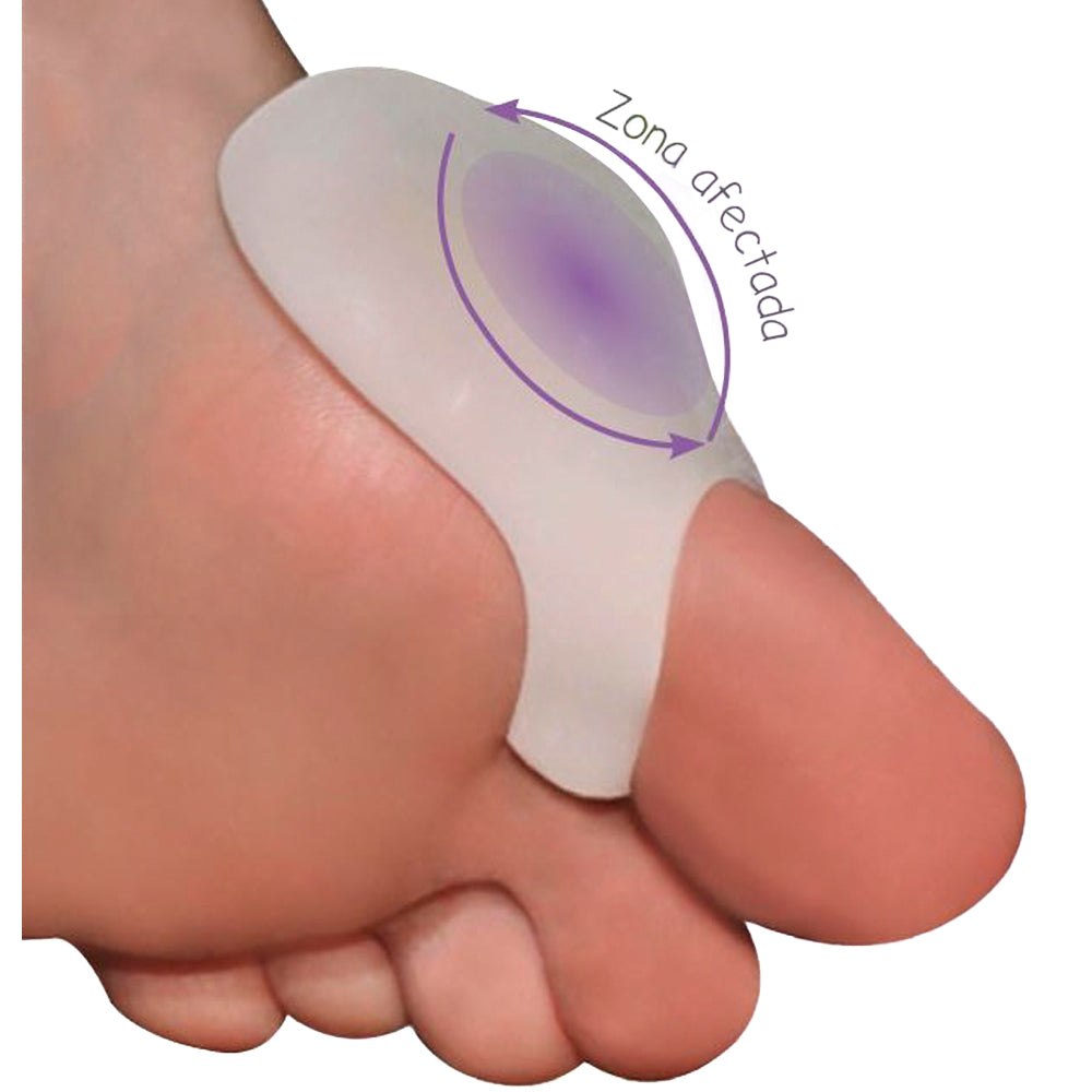 Protector De Juanete M.Color Croydon para Hombre y Mujer